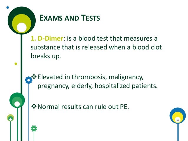 attack test dimer heart for d and Embolic diseases thromboembolic attack test dimer heart for d and Embolic diseases thromboembolic