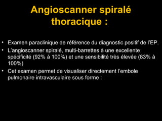 Angioscanner spiralé
thoracique :
• Examen paraclinique de référence du diagnostic positif de l’EP.
• L’angioscanner spiralé, multi-barrettes à une excellente
spécificité (92% à 100%) et une sensibilité très élevée (83% à
100%)
• Cet examen permet de visualiser directement l’embole
pulmonaire intravasculaire sous forme :
 