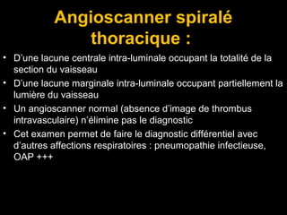 Angioscanner spiralé
thoracique :
• D’une lacune centrale intra-luminale occupant la totalité de la
section du vaisseau
• D’une lacune marginale intra-luminale occupant partiellement la
lumière du vaisseau
• Un angioscanner normal (absence d’image de thrombus
intravasculaire) n’élimine pas le diagnostic
• Cet examen permet de faire le diagnostic différentiel avec
d’autres affections respiratoires : pneumopathie infectieuse,
OAP +++
 
