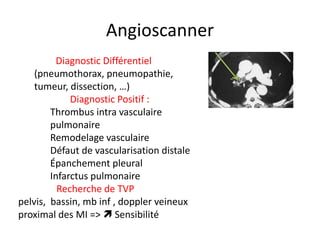 Angioscanner
Diagnostic Différentiel
(pneumothorax, pneumopathie,
tumeur, dissection, …)
Diagnostic Positif :
Thrombus intra vasculaire
pulmonaire
Remodelage vasculaire
Défaut de vascularisation distale
Épanchement pleural
Infarctus pulmonaire
Recherche de TVP
pelvis, bassin, mb inf , doppler veineux
proximal des MI =>  Sensibilité
 