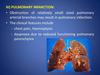 III) PULMONARY INFARCTION:
• Obstruction of relatively small sized pulmonary
arterial branches may result in pulmonary infarction.
• The clinical features include
- chest pain, Haemoptysis
- dyspnoea due to reduced functioning pulmonary
parenchyma
 