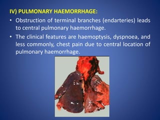 IV) PULMONARY HAEMORRHAGE:
• Obstruction of terminal branches (endarteries) leads
to central pulmonary haemorrhage.
• The clinical features are haemoptysis, dyspnoea, and
less commonly, chest pain due to central location of
pulmonary haemorrhage.
 