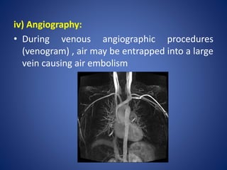 iv) Angiography:
• During venous angiographic procedures
(venogram) , air may be entrapped into a large
vein causing air embolism
 