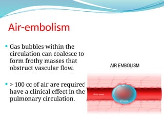 EMBOLISM - definition and classification | PPTX