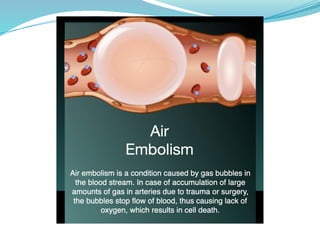 EMBOLISM - definition and classification | PPTX