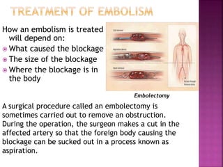 How an embolism is treated
will depend on:
 What caused the blockage
 The size of the blockage
 Where the blockage is in
the body
A surgical procedure called an embolectomy is
sometimes carried out to remove an obstruction.
During the operation, the surgeon makes a cut in the
affected artery so that the foreign body causing the
blockage can be sucked out in a process known as
aspiration.
Embolectomy
 