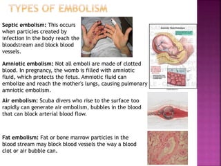 Septic embolism: This occurs
when particles created by
infection in the body reach the
bloodstream and block blood
vessels.
Amniotic embolism: Not all emboli are made of clotted
blood. In pregnancy, the womb is filled with amniotic
fluid, which protects the fetus. Amniotic fluid can
embolize and reach the mother's lungs, causing pulmonary
amniotic embolism.
Air embolism: Scuba divers who rise to the surface too
rapidly can generate air embolism, bubbles in the blood
that can block arterial blood flow.
Fat embolism: Fat or bone marrow particles in the
blood stream may block blood vessels the way a blood
clot or air bubble can.
 