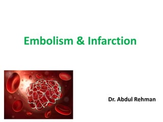 Dr. Abdul Rehman
Embolism & Infarction
 