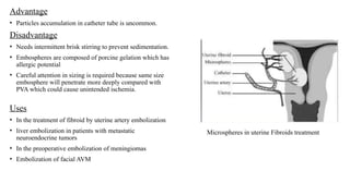 Embosphere embolizing agent( Interventional Radiology).pptx