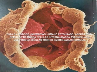 ESTA É A FOTO DE UM EMBRIÃO HUMANO ESTOURADO: ABERTO PARA  REMOÇÃO DA MASSA CELULAR INTERNA (MASSA AVERMELHADA) QUE PRODUZ CÉLULAS TRONCO EMBRIONÁRIAS HUMANAS. 