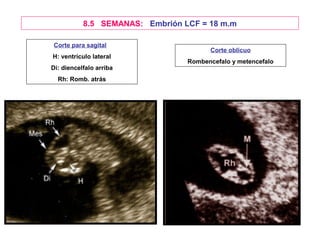 8.5 SEMANAS: Embrión LCF = 18 m.m

Corte para sagital
                                       Corte oblicuo
H: ventrículo lateral
                                 Rombencefalo y metencefalo
Di: diencelfalo arriba
  Rh: Romb. atrás
 