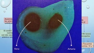 Arteria umbilical única
Ausencia de una de
las arterias
umbilicales
El cordón sólo
cuenta
con dos vasos: Una
arteria y una vena
Incidencia del 0,5 al
0,7% de todos los
embarazos
Lo más común es
que falte la
izquierda
El 40% no tiene otra
malformación pero puede
representar un retraso en el
crecimiento intrauterino
30- 60% presentan
alteraciones estructurales
asociadas
10 – 19% tienen
cromosopatías
Las más frecuentes las del aparato
genitourinario,
las extremidades, las gastrointestinales,
la cardiovadculares
Las más frecuentes
Son las trisomías 18 y 13
 