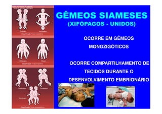 GÊMEOS SIAMESES
 (XIFÓPAGOS - UNIDOS)

       OCORRE EM GÊMEOS
        MONOZIGÓTICOS


  OCORRE COMPARTILHAMENTO DE
       TECIDOS DURANTE O
  DESENVOLVIMENTO EMBRIONÁRIO
 