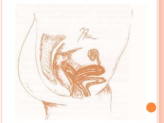  Se produce un nuevo espacio llamado celoma extraembrionario.