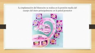 La implantación del blastocito se realiza en la porción media del
cuerpo del útero principalmente en la pared posterior
 
