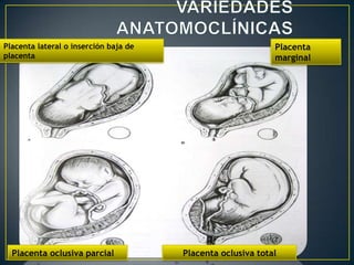Embriología anomalías de implantación