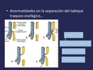 • Anormalidades en la separación del tabique
  traqueo-esofágico…
 