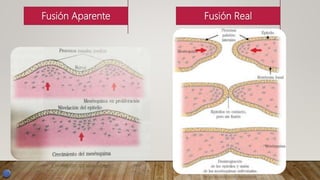 Fusión RealFusión Aparente
 
