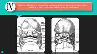 Las fosas olfatorias se acercan y el espacio entre ambas se eleva dando lugar al dorso y
punta de la nariz. Los orificios nasales se dirigen hacia abajo.
 