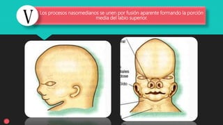 Los procesos nasomedianos se unen por fusión aparente formando la porción
media del labio superior.
 