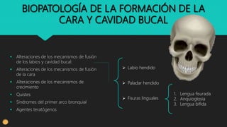 BIOPATOLOGÍA DE LA FORMACIÓN DE LA
CARA Y CAVIDAD BUCAL
 Alteraciones de los mecanismos de fusión
de los labios y cavidad bucal:
 Alteraciones de los mecanismos de fusión
de la cara
 Alteraciones de los mecanismos de
crecimiento
 Quistes
 Síndromes del primer arco bronquial
 Agentes teratógenos
 Labio hendido
 Paladar hendido
 Fisuras linguales
1. Lengua fisurada
2. Anquioglosia
3. Lengua bífida
 