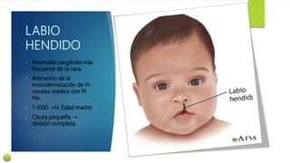• Anomalía congénita más
frecuente de la cara.
• Alteración de la
mesodermización de Pr
nasales medios con Pr
Mx.
• 1-1000. +H. Edad madre.
• Cisura pequeña ->
división completa.
 