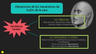 Alteraciones de los mecanismos de
fusión de la cara.
Hendiduras
Faciales
Falta de fusión del proceso nasal externo con
proceso maxilar corresponiente.
Falta en la fusión superficial de los procesos maxilares y
mandibulares.
- Boca muy grande: Macrostomia
- Boca muy pequeña: Macrostomia
 