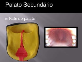 Palato Secundário

   Rafe do palato
 