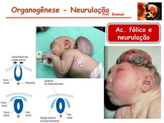 Organogênese - Neurulação Emanuel
                       Prof.




                              Ac. fólico e
                              neurulação
 