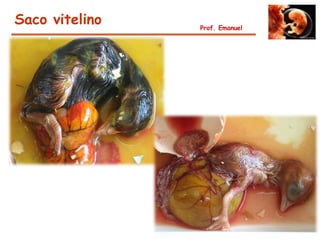 Saco vitelino   Prof. Emanuel
 