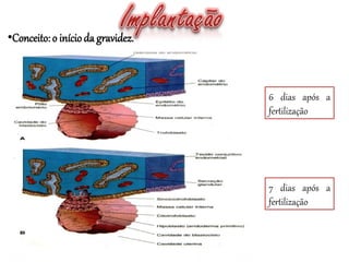 •Conceito: o inícioda gravidez.
6 dias após a
fertilização
7 dias após a
fertilização
 