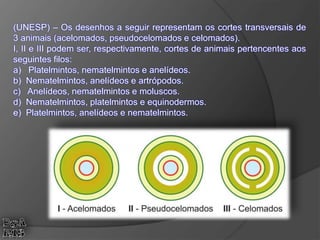 (UNESP) – Os desenhos a seguir representam os cortes transversais de
3 animais (acelomados, pseudocelomados e celomados).
I, II e III podem ser, respectivamente, cortes de animais pertencentes aos
seguintes filos:
a) Platelmintos, nematelmintos e anelídeos.
b) Nematelmintos, anelídeos e artrópodos.
c) Anelídeos, nematelmintos e moluscos.
d) Nematelmintos, platelmintos e equinodermos.
e) Platelmintos, anelídeos e nematelmintos.
 