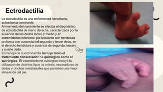 Ectrodactilia
La ectrodactilia es una enfermedad hereditaria,
autosómica dominante.
Al momento del nacimiento se efectúa el diagnóstico
de ectrodactilia de mano derecha, caracterizada por la
ausencia de los dedos índice y medio y en
extremidades inferiores: pie izquierdo con hendidura
profunda con ausencia del segundo y tercer dedo, en
el derecho hendidura y ausencia de segundo, tercero
y cuarto dedo.
El manejo de la ectrodactilia incluye tanto el
tratamiento conservador no quirúrgico como el
quirúrgico. El tratamiento no quirúrgico incluye la
utilización de distintos tipos de ortesis, separadores de
dedos y cinchas metatarsales que permiten una mejor
alineación del pie.
 