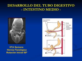DESARROLLO DEL TUBO DIGESTIVODESARROLLO DEL TUBO DIGESTIVO
- INTESTINO MEDIO -- INTESTINO MEDIO -
6TA Semana
Hernia Fisiológica
Rotación Inicial 90º
 