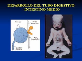 DESARROLLO DEL TUBO DIGESTIVODESARROLLO DEL TUBO DIGESTIVO
- INTESTINO MEDIO- INTESTINO MEDIO
 
