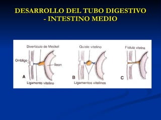 DESARROLLO DEL TUBO DIGESTIVODESARROLLO DEL TUBO DIGESTIVO
- INTESTINO MEDIO- INTESTINO MEDIO
 
