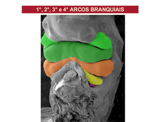 1 °, 2 °, 3° e 4° ARCOS BRANQUIAIS                                                                       