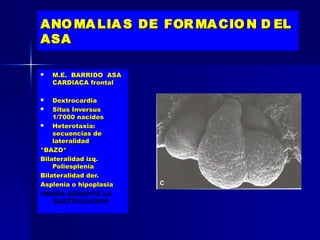 ANO MA LIA S DE FOR MA CIO N D EL
ASA

   M.E. BARRIDO ASA
    CARDIACA frontal

   Dextrocardia
   Situs Inversus
    1/7000 nacidos
   Heterotaxia:
    secuencias de
    lateralidad
*BAZO*
Bilateralidad izq.
    Poliesplenia
Bilateralidad der.
Asplenia o hipoplasia
GENES DURANTE LA
    GASTRULACION
 
