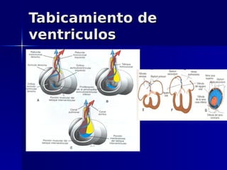 Tabicamiento de
ventriculos
 