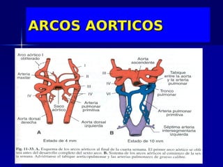 ARCOS AORTICOS
 