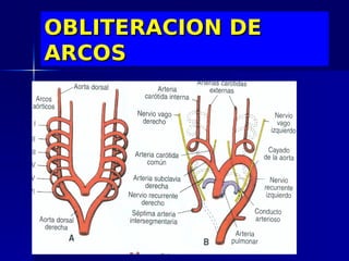 OBLITERACION DE
ARCOS
 