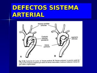 DEFECTOS SISTEMA
ARTERIAL
 