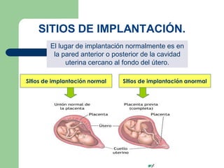 SITIOS DE IMPLANTACIÓN.
Sitios de implantación normal Sitios de implantación anormal
El lugar de implantación normalmente es en
la pared anterior o posterior de la cavidad
uterina cercano al fondo del útero.
 