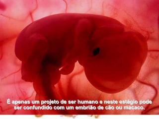 É apenas um projeto de ser humano e neste estágio pode                  ser confundido com um embrião de cão ou macaco.