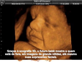 Graças à ecografia 3D, o futuro bebê mostra a quem                       está de fora, em imagens de grande nitidez, até mesmo                 suas expressões faciais.