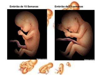 Embrião de 15 SemanasEmbrião de 23 semanas