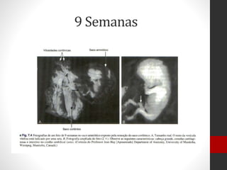 9 Semanas
 