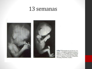 13 semanas
 