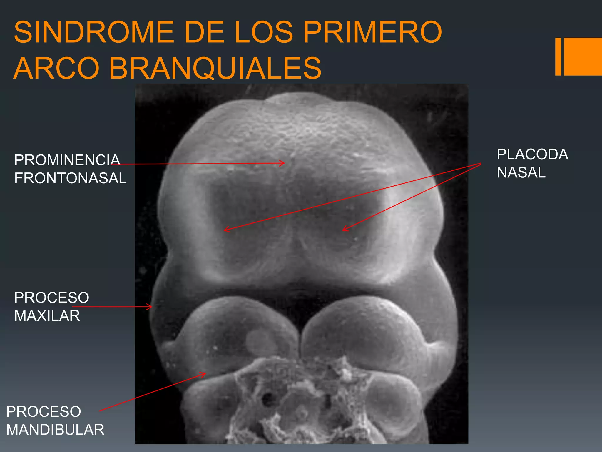 Labios Rombicos Embriologia, anatomia y clasificacion de labio y | PPTX