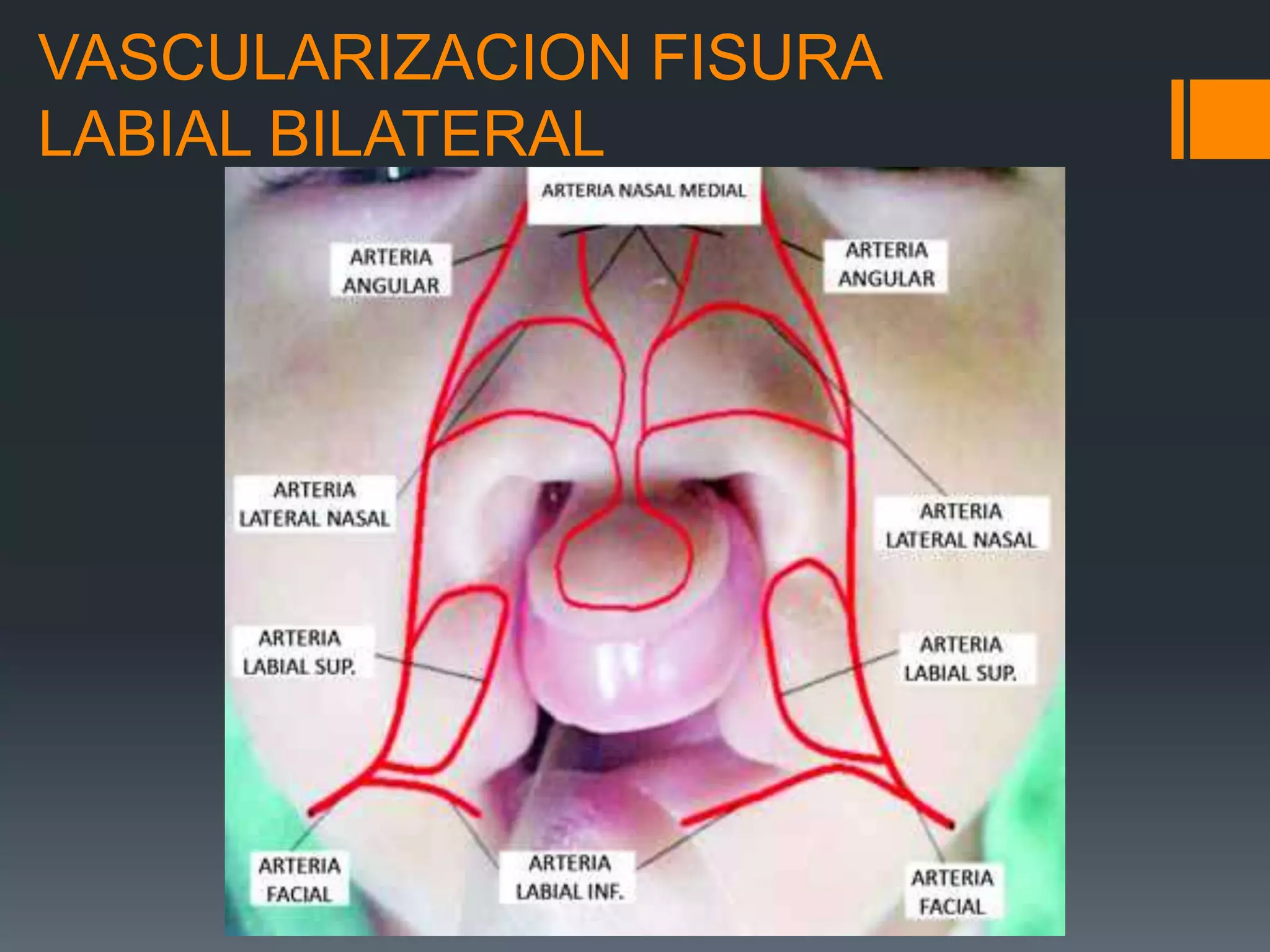 Embriologia, anatomia y clasificacion de labio y | PPTX